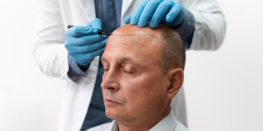 Hair Transplant Surgery