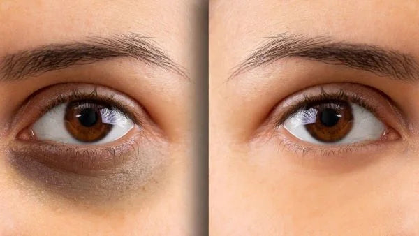 glutathione function in the body Glutathione IV Therapy: What You Need to Know glutathione function in the body Glutathione IV Therapy: What You Need to Know