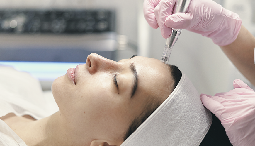 Microneedling